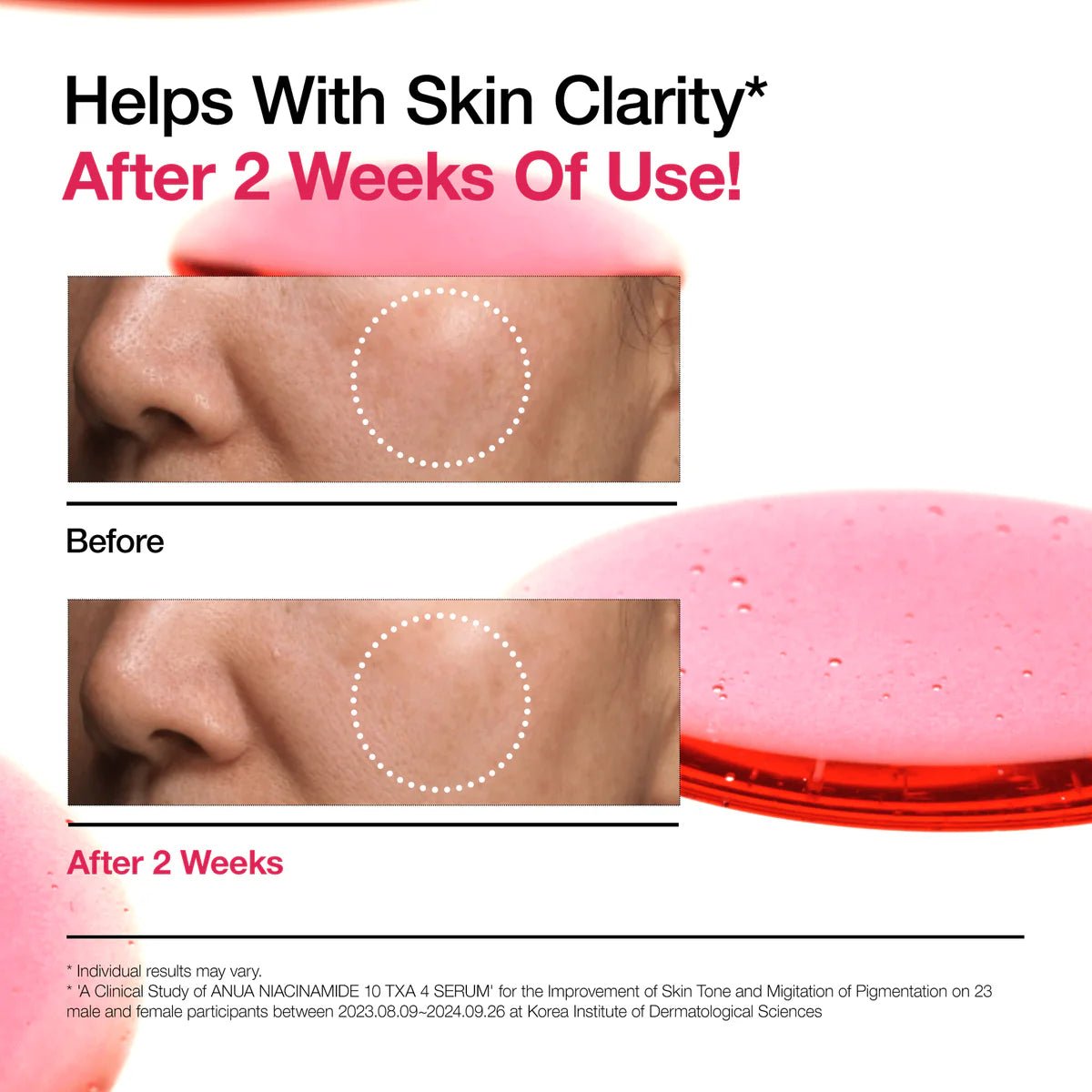 ANUA | Sèrum. Niacinamide 10% + TXA 4% Serum (Renewal) – 30ml - Haru Skin Haru Skin