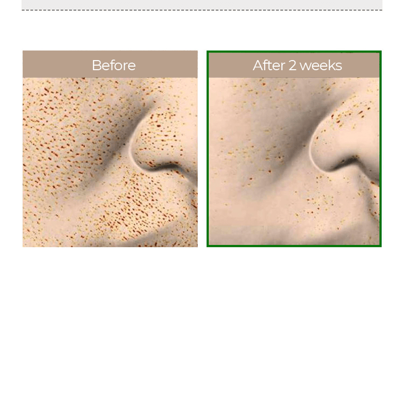 VT COSMETICS | Tratamiento Exfoliante VT Reedle Shot 100 - Haru Skin Haru Skin