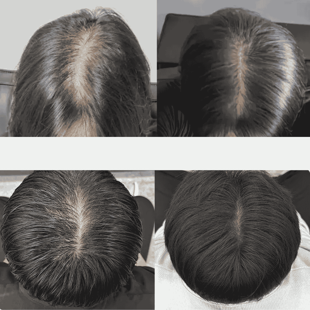 Lilyeve GROW:TURN Exosome Brush Ampoule 
