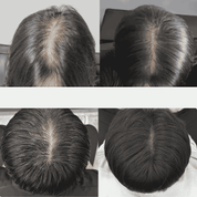Lilyeve GROW:TURN Exosome Brush Ampoule 