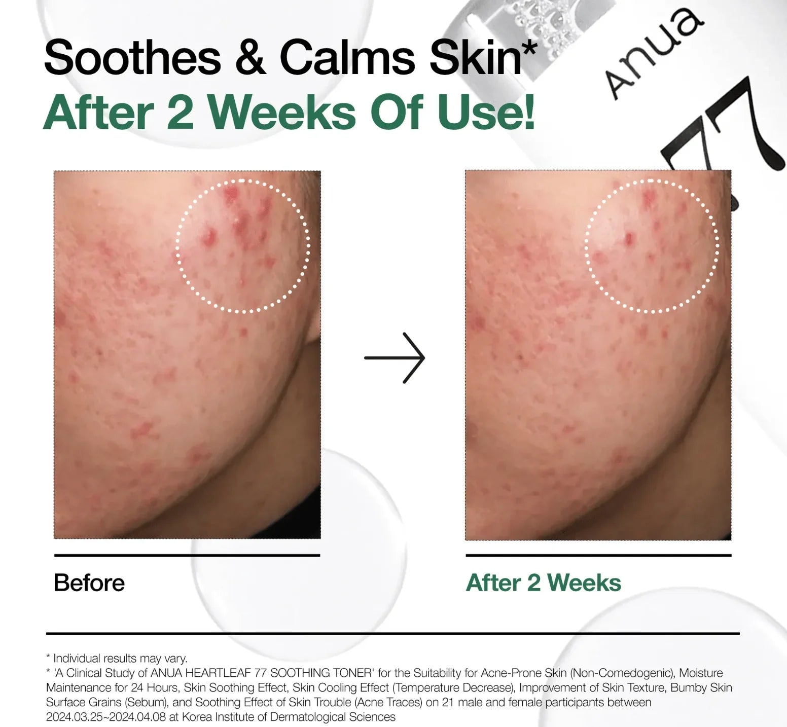 ANUA | Tónico. Heartleaf 77 Soothing Toner - 250ml - Haru Skin Haru Skin