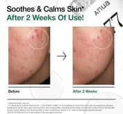 ANUA | Tónico. Heartleaf 77 Soothing Toner - 250ml - Haru Skin Haru Skin