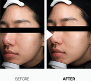 ANUA | Tónico. Heartleaf 77 Soothing Toner - 250ml - Haru Skin Haru Skin