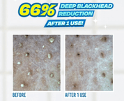 JUMISO | Exfoliante. Blackhead Melting Softner + Pads + Swabs – 150 ml - Haru Skin Haru Skin