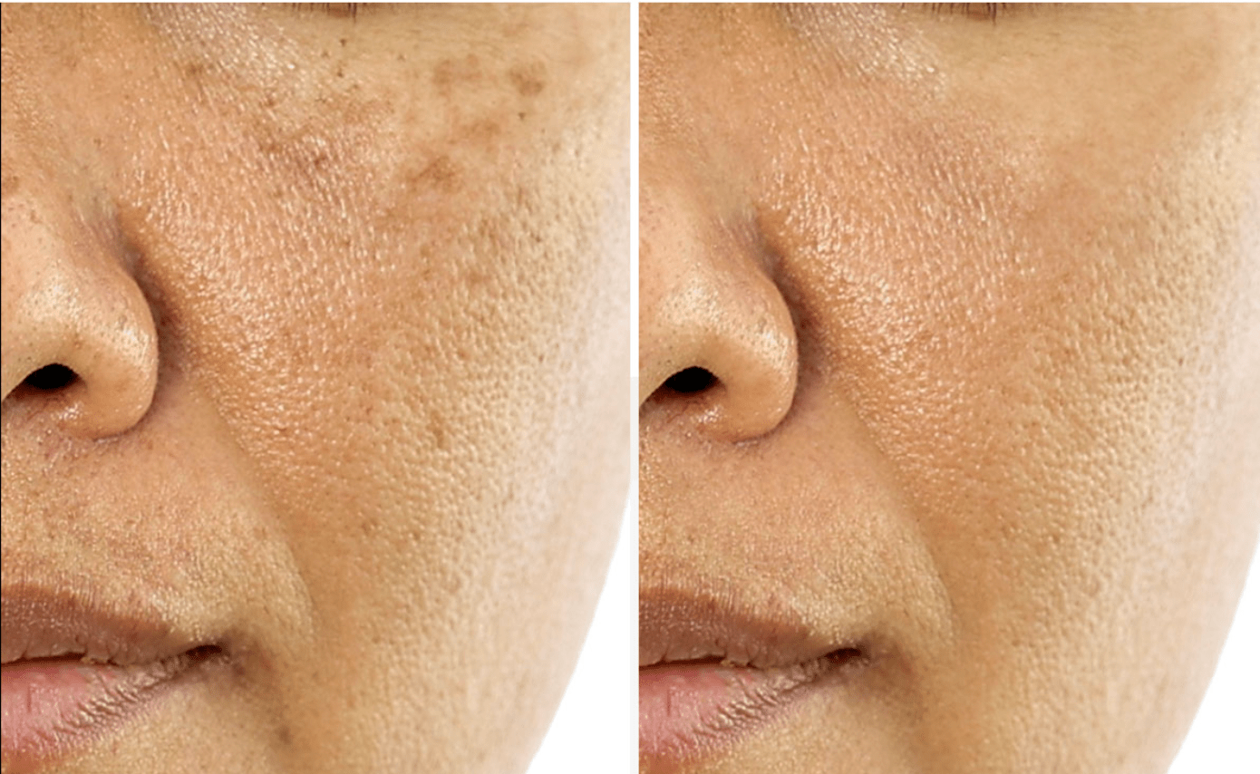 Medicube | Hidratante. Deep Vita C Capsule Cream – 55g - Haru Skin Haru Skin