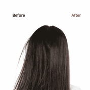 MOEV | Tratamiento capilar. Annurcatin Treatment – 200g