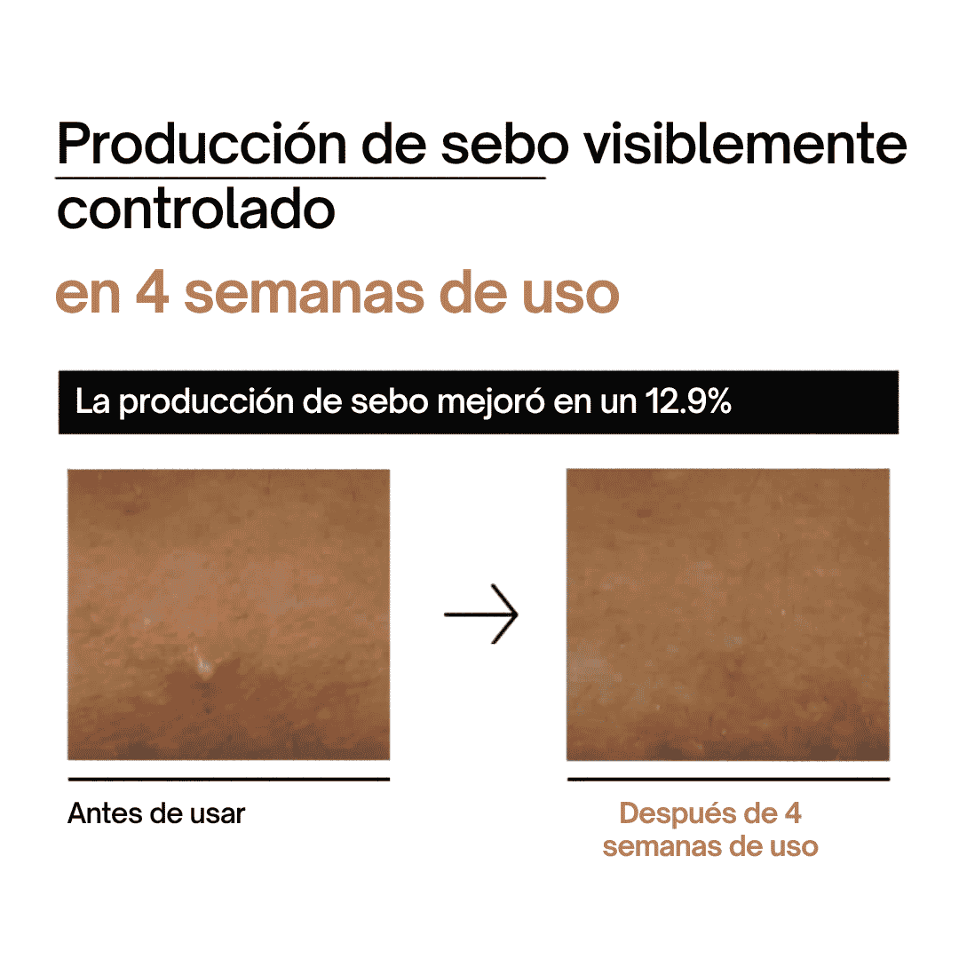ANUA | Tónico. Rice 70 Glow Milky Toner – 250ml