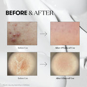 VT COSMETICS | Tratamiento Exfoliante VT Reedle Shot 100 - Haru Skin Haru Skin