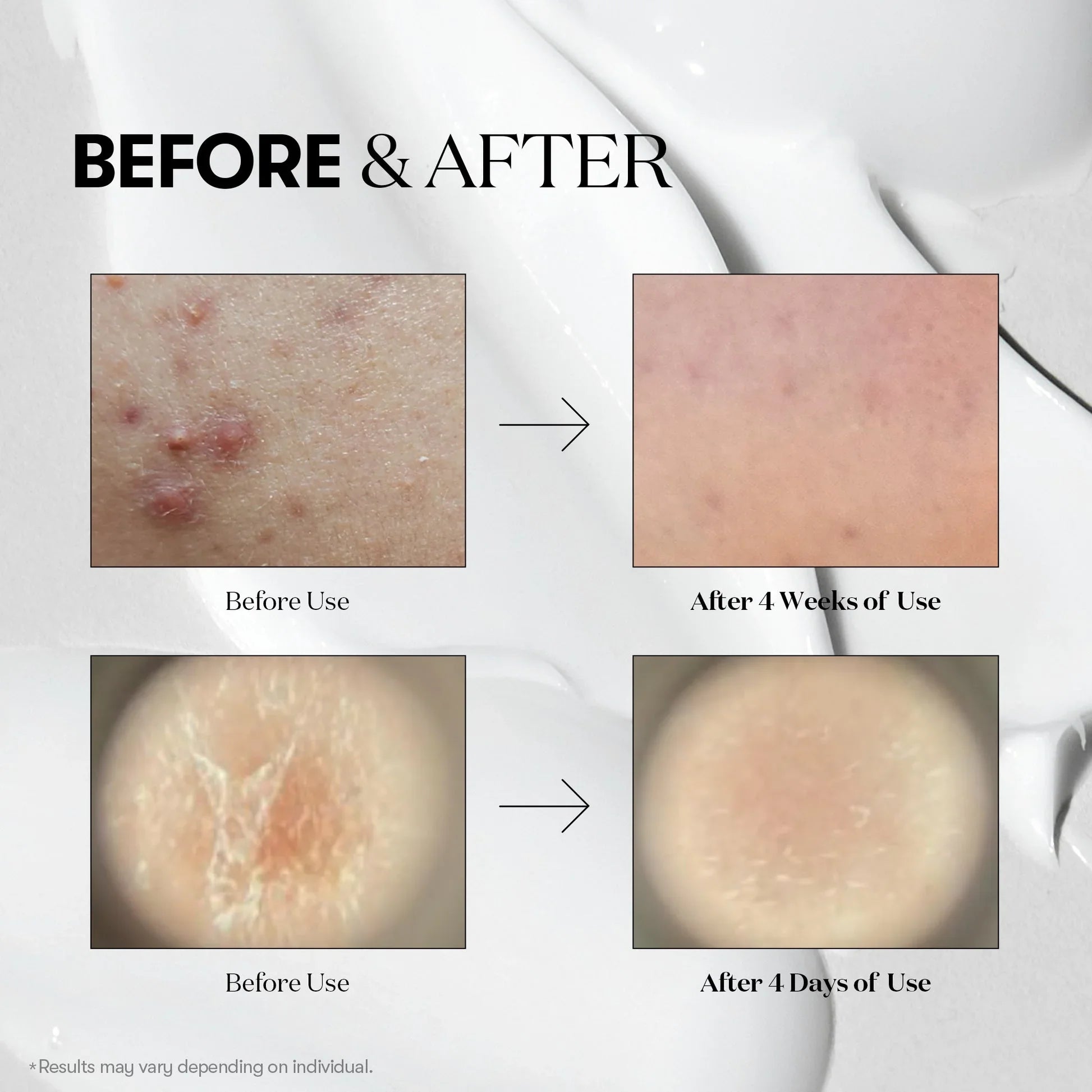 VT COSMETICS | Tratamiento Exfoliante VT Reedle Shot 100 - Haru Skin Haru Skin