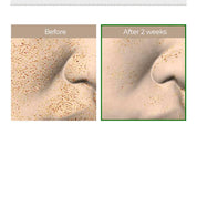 VT COSMETICS | Tratamiento Exfoliante VT Reedle Shot 100 - Haru Skin Haru Skin